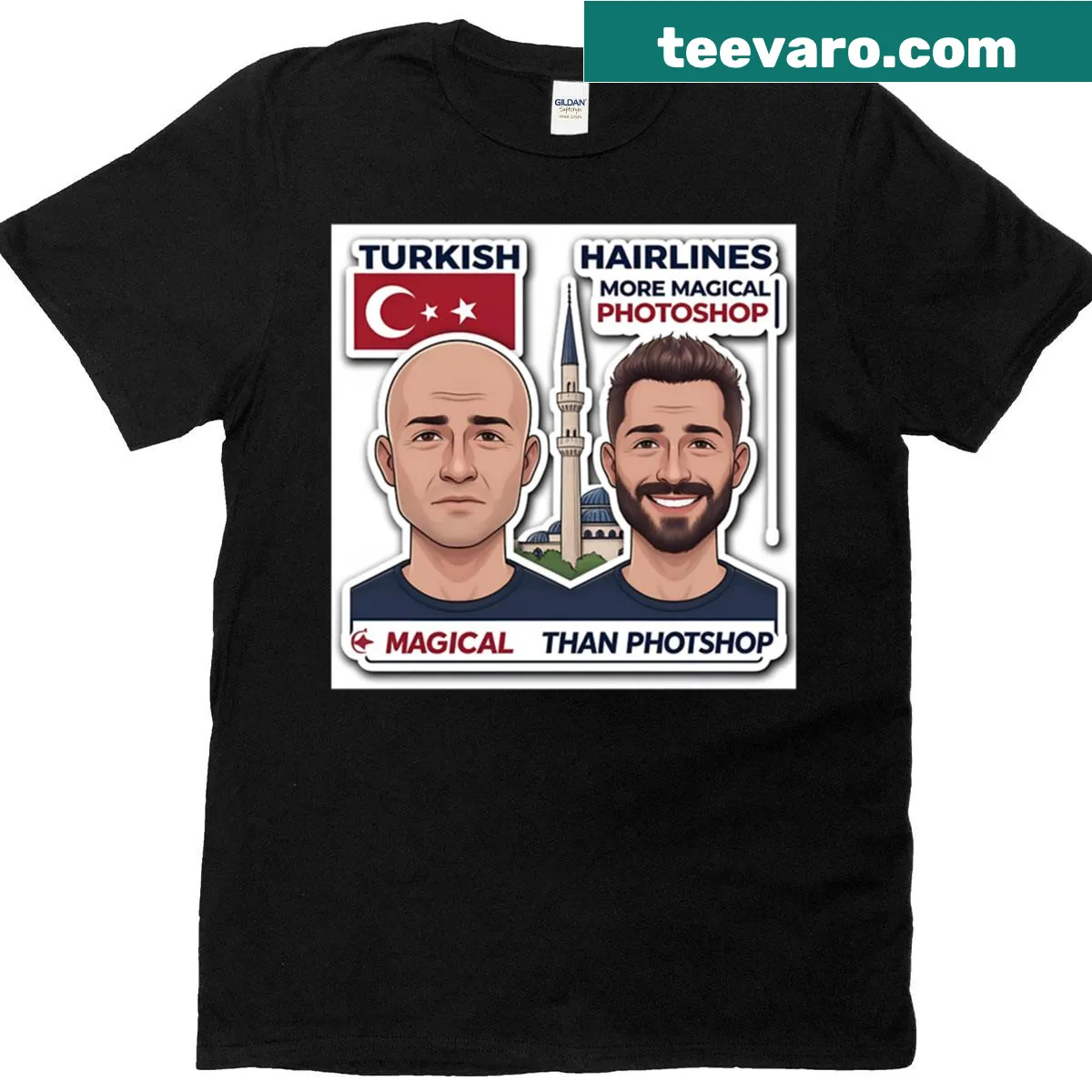 Funny t-shirt featuring a cartoon graphic of hair transplant before and after — on a men's t-shirt